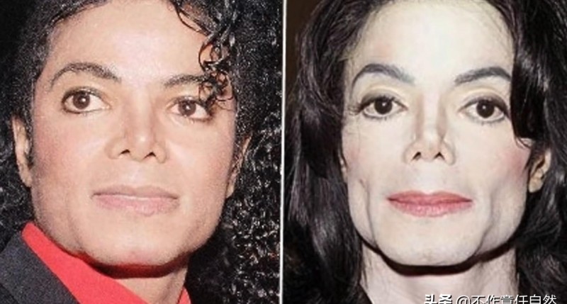 迈克杰克逊整容前(迈克杰克逊面容变化史)