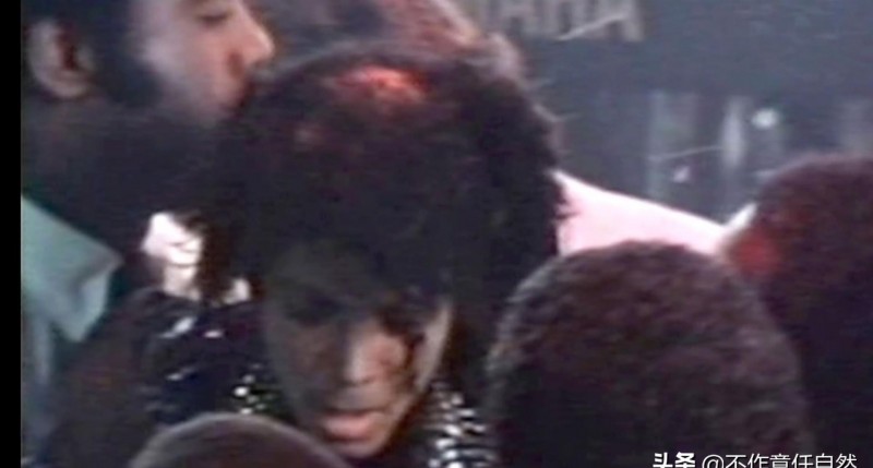 迈克杰克逊整容前(迈克杰克逊面容变化史)