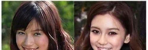 赵寅成整容后的对比（赵寅成鼻歪疑似整容）