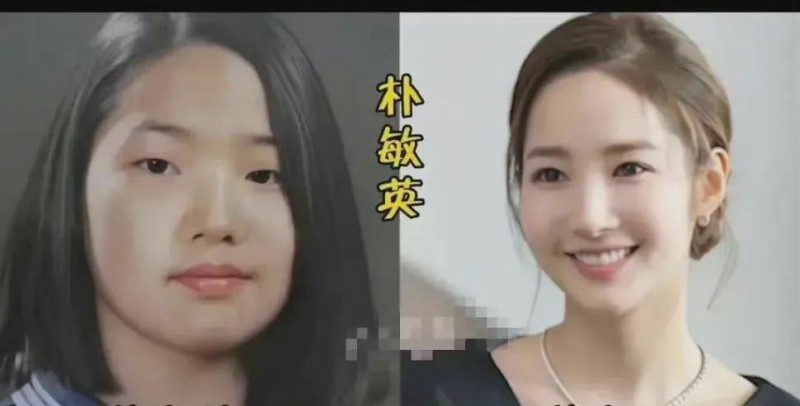 朴敏英整容前照片（韩国女明星整容前后对比照）