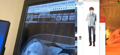 ​嫖老师近期状况怎么样 手术难度很大但PDD心态很乐观