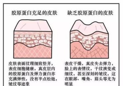 ​玻尿酸和精华液哪个好(含尿酸的护肤品有什么作用)