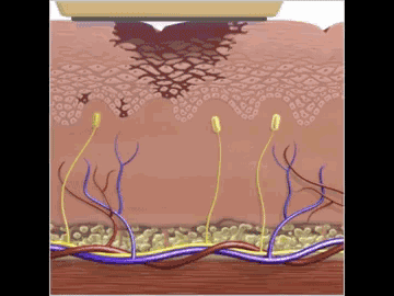 深唇浅唇色区别图(图文讲解嘴唇颜色的区别)