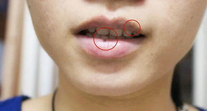 深唇浅唇色区别图(图文讲解嘴唇颜色的区别)