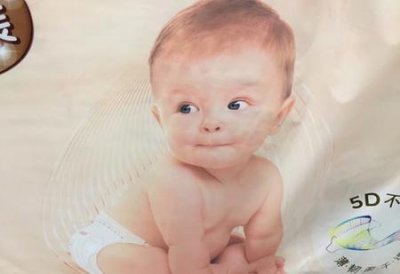 ​婴儿脾胃虚弱怎么调理(怎样调理小儿脾胃虚弱)