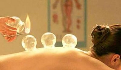 ​中药拔罐减肥靠谱吗(中药拔罐减肥有效吗)