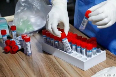 ​验孕棒c区一条杠是什么意思(秀儿验孕棒c区一条杠是什么意思)