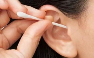 ​耳屎是怎么样保护人体耳朵的