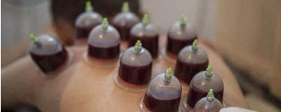 ​拔罐的好处和坏处