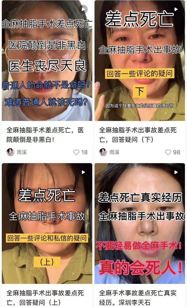 官方通报女网红抽脂去世（网红曝好友抽脂去世）(16)