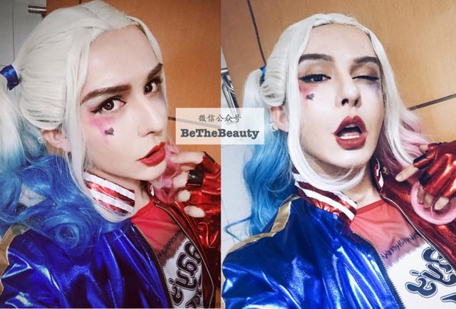 全脸整容恢复过程（越整越自然的脸）(14)