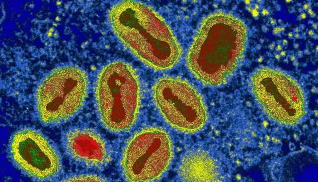 古罗马最惨的瘟疫（两次大规模瘟疫与古罗马帝国的衰败）(4)