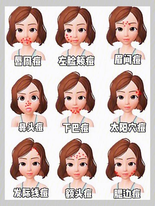 脸上长痘的位置代表什么（你知道了吗）