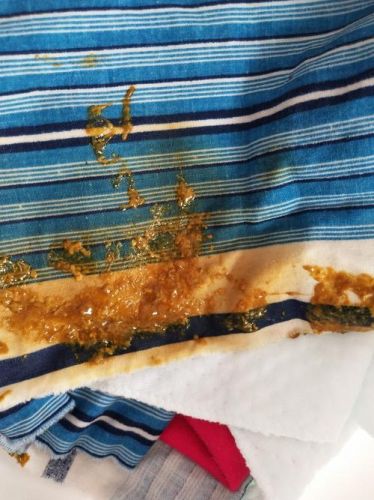 婴儿拉稀屎怎么回事啊？婴儿拉稀屎怎么回事儿-第1张图片-