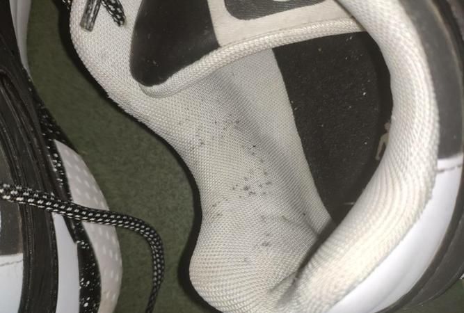 白鞋发霉了怎么才能把霉斑洗掉能用消毒水吗