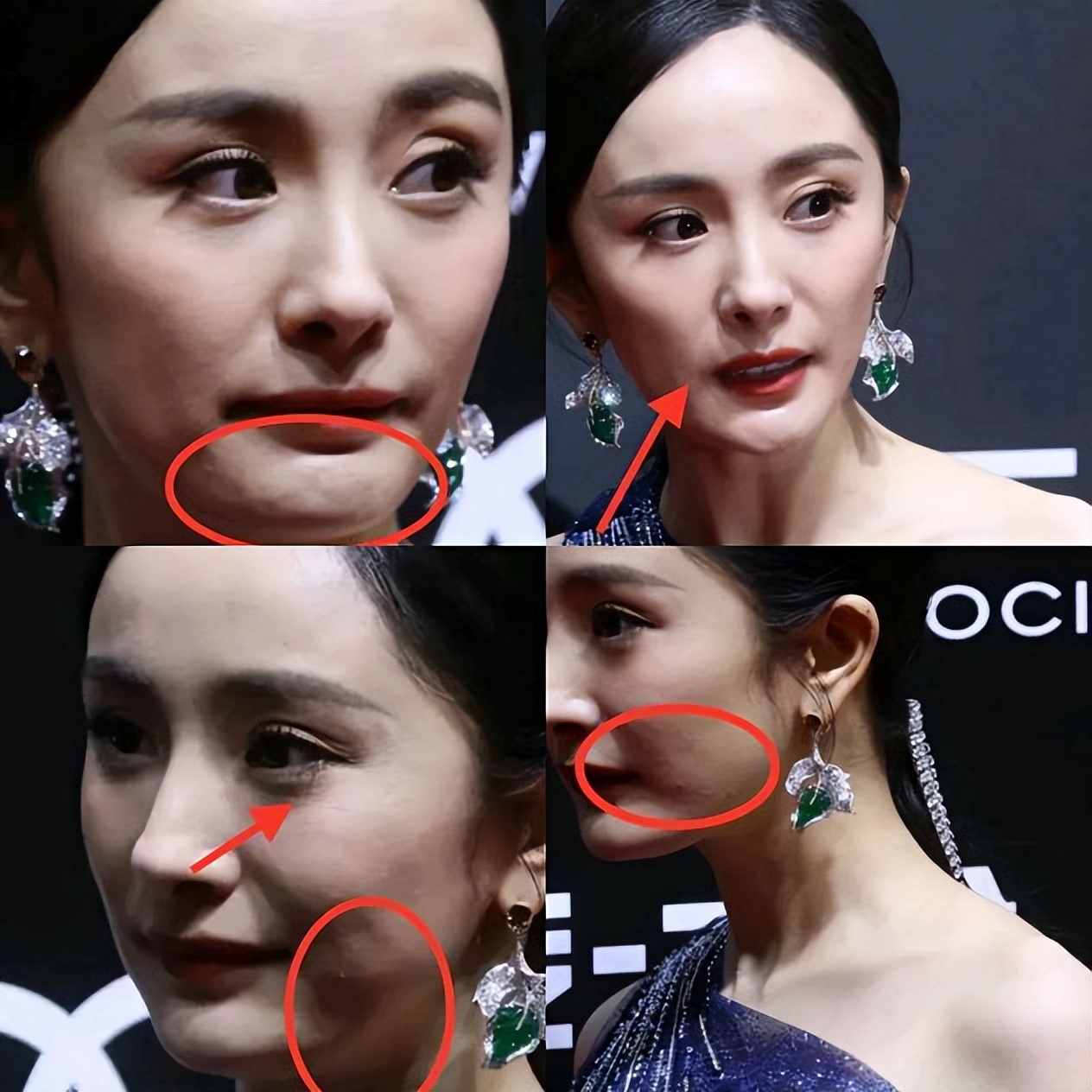 蒋欣的麒麟臂,宋佳的法令纹,打了多少“花瓶”女星的脸