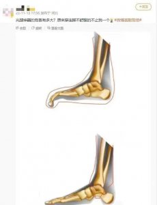 ​全网姑娘炸锅！看似漂亮，却被嘲“现代刑具”…