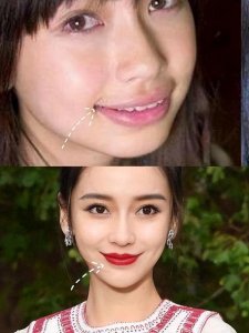 ​比“法令纹”更可怕的是“嘴凸”？看完这篇文章，或许就明白了