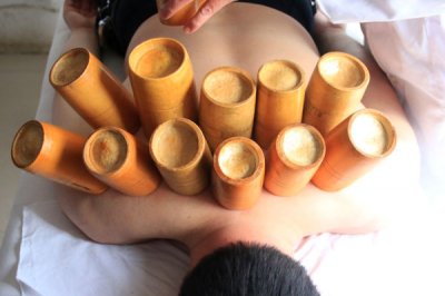 ​拔罐的好处与功效 拔罐对身体有哪些好处？拔罐完不注意2件事，你可能就“白拔
