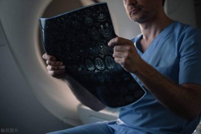 ​做一次CT对人体伤害大吗？哪些人不适合做？医生一一告诉你