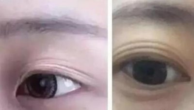 ​肾不好的人有什么表现 人肾不好身体有什么反应