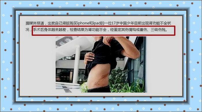 当年割肾买苹果手机，现在这个90后告诉你，少一个肾会怎么样？