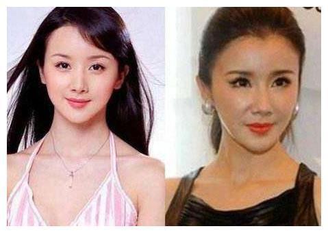 张檬耿直承认整容失败,取出假体后首次现身,网友:成功逆袭为女神