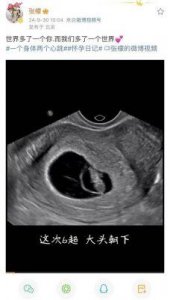 ​张檬与金圣恩官宣怀孕，夫妻幸福共享美好时刻