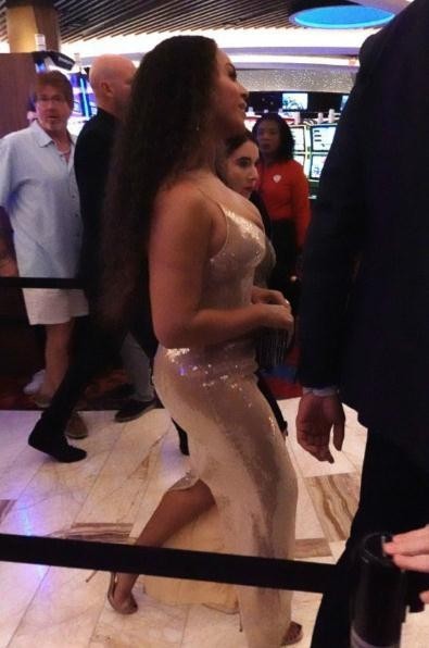 杨蓉整容了吗（杨蓉演十几岁少女全靠滤镜撑着）