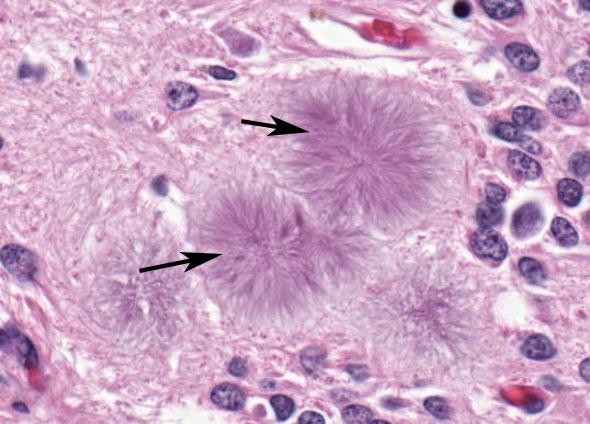 人真的能被笑死吗（笑死了不是一句玩笑）(25)