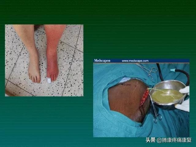 肌肉疼痛的原因和解决方法（肌肉与疼痛原因）(26)