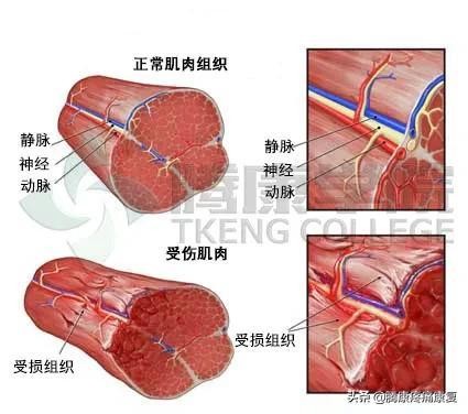 肌肉疼痛的原因和解决方法（肌肉与疼痛原因）(6)