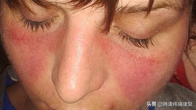 肌肉疼痛的原因和解决方法（肌肉与疼痛原因）(17)