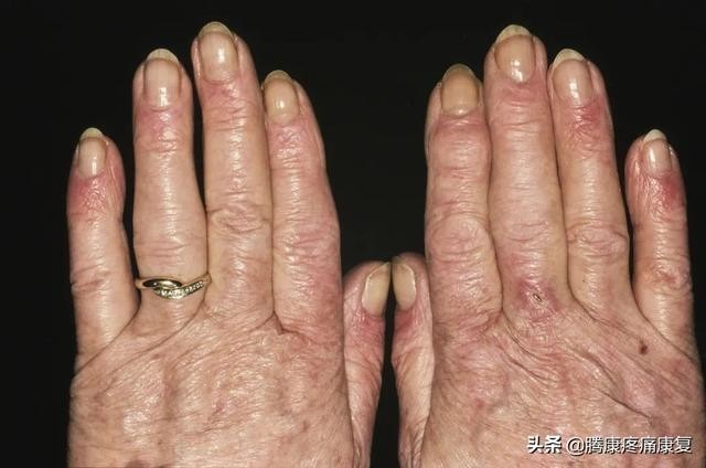 肌肉疼痛的原因和解决方法（肌肉与疼痛原因）(16)