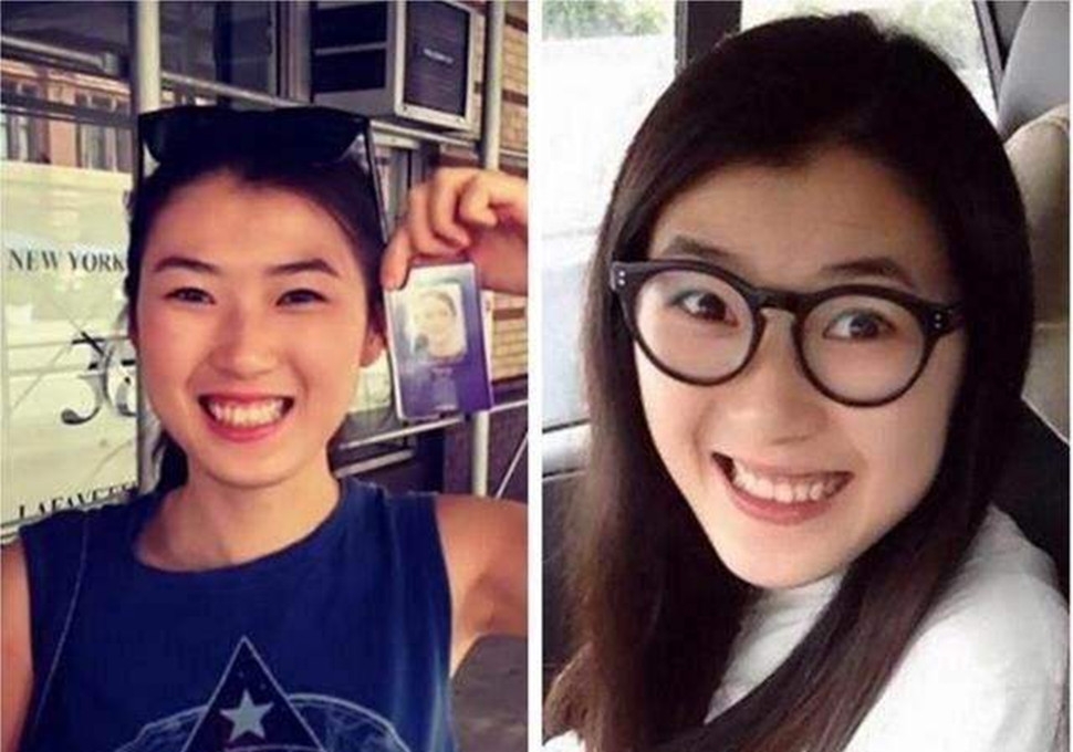 王菲的女儿为什么是兔唇(王菲为什么生下唇裂)  第5张