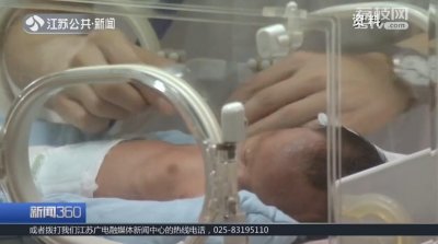 ​新生儿黄疸肉眼不易发现 手机软件实时监测更准确