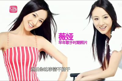 ​薇娅整容前后照片 和早期的照片相比确实有变化