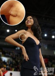 ​张梓琳真实身高多少 张梓琳整容了吗