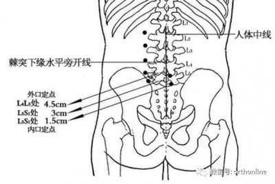 ​医考知识点总结：托马斯（ Thomas ）征。
