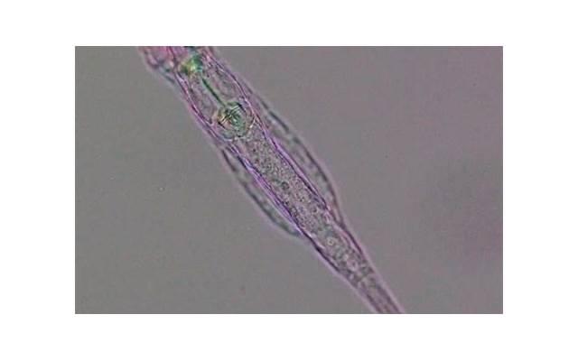 淋病潜伏期查的出来吗? 淋病潜伏期查的出来吗?