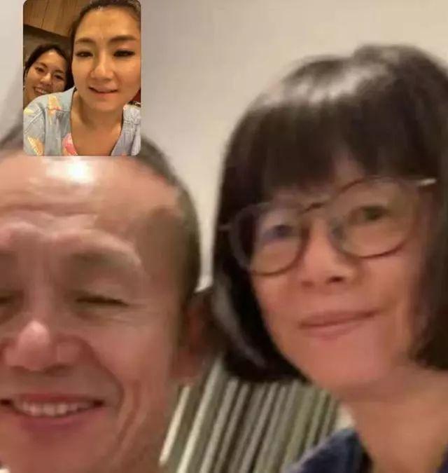 38岁selina近照素颜出镜脸色发黄，脸部疤痕清晰可见